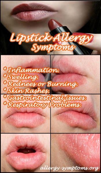 dior lip oil allergic reaction|lipstick contact reactions.